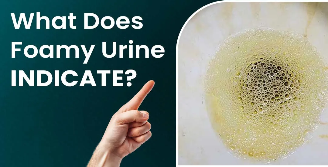 What Does Foamy Urine Indicate?